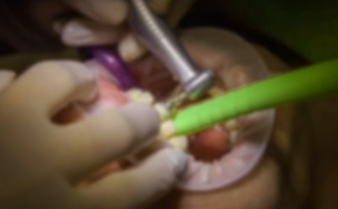 ӛ��һ�ΰ�����ӛ