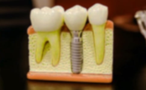 ������ӛ300�֣����x25ƪ��