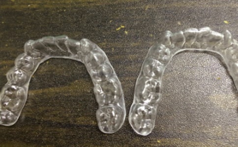 《戴牙套的青蛙王子》讀后感300字