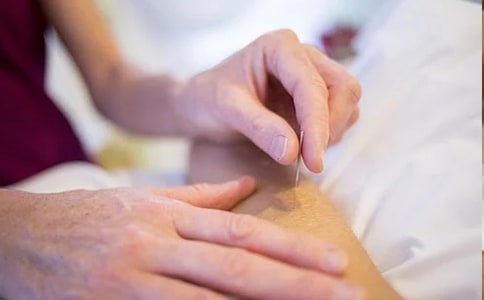 針灸實習心得體會范文