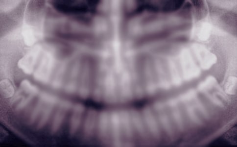 �����X��ĸ���������ӛ